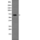 Western blot analysis of SLC6A3 expression in HEK293 cells ,The lane on the left is treated with the antigen-specific peptide.