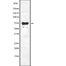 DF2244 at 1/100 staining Human prostate tissue by IHC-P. The sample was formaldehyde fixed and a heat mediated antigen retrieval step in citrate buffer was performed. The sample was then blocked and incubated with the antibody for 1.5 hours at 22¡ãC. An HRP conjugated goat anti-rabbit antibody was used as the secondary