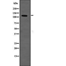 Western blot analysis of SLC12A2 expression in HEK293 cells ,The lane on the left is treated with the antigen-specific peptide.