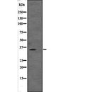 Western blot analysis of VGLL2 expression in  VGLL2 transfected 293T cell lysate,The lane on the left is treated with the antigen-specific peptide.