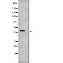 Western blot analysis of TAF7 expression in  TAF7 transfected 293T cell lysate,The lane on the left is treated with the antigen-specific peptide.