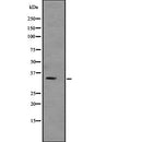 DF2256 at 1/100 staining Mouse muscle tissue by IHC-P. The sample was formaldehyde fixed and a heat mediated antigen retrieval step in citrate buffer was performed. The sample was then blocked and incubated with the antibody for 1.5 hours at 22¡ãC. An HRP conjugated goat anti-rabbit antibody was used as the secondary