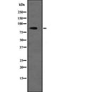 DF2257 at 1/100 staining Human brain tissue by IHC-P. The sample was formaldehyde fixed and a heat mediated antigen retrieval step in citrate buffer was performed. The sample was then blocked and incubated with the antibody for 1.5 hours at 22¡ãC. An HRP conjugated goat anti-rabbit antibody was used as the secondary