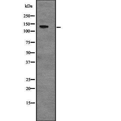 Western blot analysis of USP28 expression in  NIH3T3 whole cell lysate ;,The lane on the left is treated with the antigen-specific peptide.