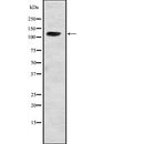 DF2259 at 1/100 staining Rat brain tissue by IHC-P. The sample was formaldehyde fixed and a heat mediated antigen retrieval step in citrate buffer was performed. The sample was then blocked and incubated with the antibody for 1.5 hours at 22¡ãC. An HRP conjugated goat anti-rabbit antibody was used as the secondary