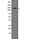 Western blot analysis of USP48 expression in  Hela cell lysate,The lane on the left is treated with the antigen-specific peptide.