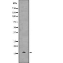 Western blot analysis of UBE2D3 expression in  Hela cell lysate,The lane on the left is treated with the antigen-specific peptide.