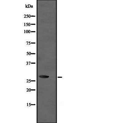 Western blot analysis of UBE2R2 expression in  Jurkat whole cell lysate ,The lane on the left is treated with the antigen-specific peptide.