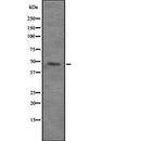 Western blot analysis of VPS4B expression in  293T whole cell lysate ,The lane on the left is treated with the antigen-specific peptide.