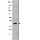 Western blot analysis of CACNG5 expression in K562 cell lysate ,The lane on the left is treated with the antigen-specific peptide.