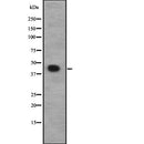 Western blot analysis of CACNG8 expression in HEK293 cells ,The lane on the left is treated with the antigen-specific peptide.