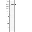 Western blot analysis of CACNA1C expression in  Human Heart lysate in RIPA buffer ,The lane on the left is treated with the antigen-specific peptide.