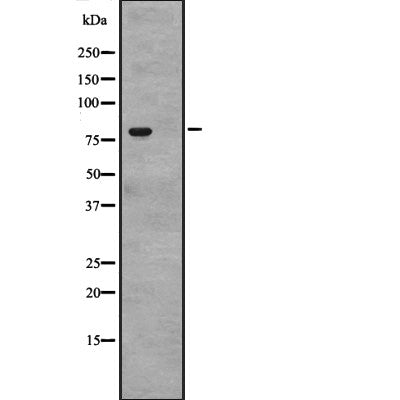 Western blot analysis of CACNB4 expression in  Human Bone Marrow lysates  in RIPA buffer,The lane on the left is treated with the antigen-specific peptide.