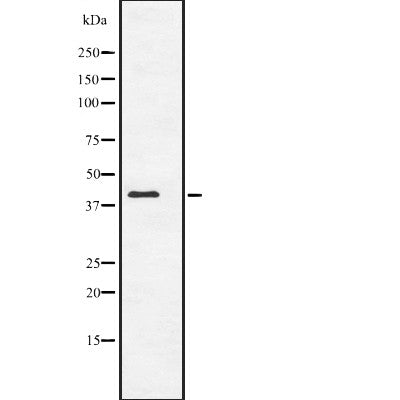 Western blot analysis of ACTC1 expression in  NIH3T3 whole cell lysate ;,The lane on the left is treated with the antigen-specific peptide.