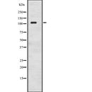 Western blot analysis of ADCY8 expression in  HL60 cell lysate ,The lane on the left is treated with the antigen-specific peptide.