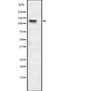 Western blot analysis of extracts from HepG2, using ASPP1 Antibody. The lane on the left was treated with blocking peptide.