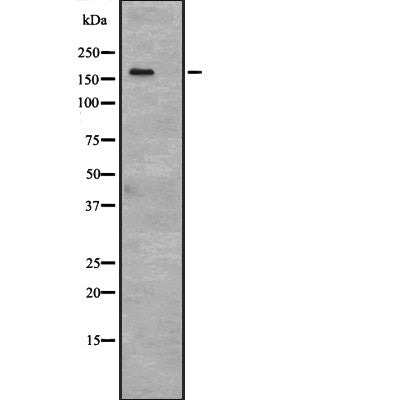 Western blot analysis of ASPP2 expression in HEK293 cells ,The lane on the left is treated with the antigen-specific peptide.