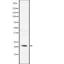 DF2276 at 1/100 staining Mouse lung tissue by IHC-P. The sample was formaldehyde fixed and a heat mediated antigen retrieval step in citrate buffer was performed. The sample was then blocked and incubated with the antibody for 1.5 hours at 22¡ãC. An HRP conjugated goat anti-rabbit antibody was used as the secondary