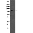 Western blot analysis of CDH12 expression in Jurkat cell lysate,The lane on the left is treated with the antigen-specific peptide.