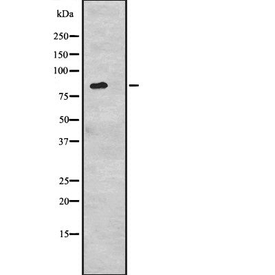 Western blot analysis of CDH6 expression in  293 cell line lysates ,The lane on the left is treated with the antigen-specific peptide.