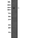 Western blot analysis of CCAR1 expression in  Hela cell lysate,The lane on the left is treated with the antigen-specific peptide.