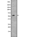 Western blot analysis of extracts from HepG2, using CCNK Antibody.