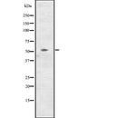 Western blot analysis of CCNL2 expression in  NCI-H460 cell line lysates ,The lane on the left is treated with the antigen-specific peptide.