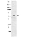 Western blot analysis of CCNL2 expression in  NCI-H460 cell line lysates ,The lane on the left is treated with the antigen-specific peptide.