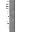 Western blot analysis of CD109 expression in  Mouse cerebellum tissue lysate ,The lane on the left is treated with the antigen-specific peptide.