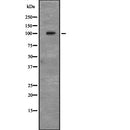 Western blot analysis of CD166 expression in HEK293 cells ,The lane on the left is treated with the antigen-specific peptide.