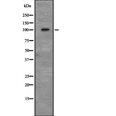 Western blot analysis of CD166 expression in HEK293 cells ,The lane on the left is treated with the antigen-specific peptide.