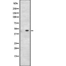 Western blot analysis of CD209 expression in HEK293 cells ,The lane on the left is treated with the antigen-specific peptide.