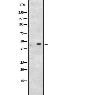 Western blot analysis of CD209 expression in HEK293 cells ,The lane on the left is treated with the antigen-specific peptide.