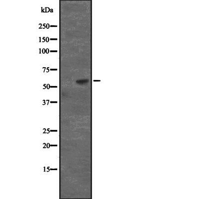 Western blot analysis of extracts from HepG2, using CD276 Antibody. The lane on the left was treated with blocking peptide.
