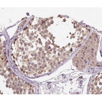AF0140 at 1/200 staining human testis tissue sections by IHC-P. The tissue was formaldehyde fixed and a heat mediated antigen retrieval step in citrate buffer was performed. The tissue was then blocked and incubated with the antibody for 1.5 hours at 22¡ãC. An HRP conjugated goat anti-rabbit antibody was used as the secondary