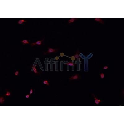 AF0140 staining HeLa  cells by IF/ICC. The sample were fixed with PFA and permeabilized in 0.1% Triton X-100,then blocked in 10% serum for 45 minutes at 25¡ãC. The primary antibody was diluted at 1/200 and incubated with the sample for 1 hour at 37¡ãC. An  Alexa Fluor 594 conjugated goat anti-rabbit IgG (H+L) antibody(Cat.