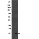 DF2303 at 1/100 staining Human pancreas tissue by IHC-P. The sample was formaldehyde fixed and a heat mediated antigen retrieval step in citrate buffer was performed. The sample was then blocked and incubated with the antibody for 1.5 hours at 22¡ãC. An HRP conjugated goat anti-rabbit antibody was used as the secondary