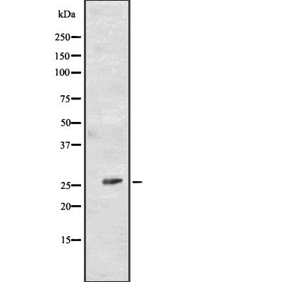 Western blot analysis of extracts from various samples, using CD81 Antibody.
 Lane 1: Hela treated with blocking peptide;
 Lane 2: Hela;
 Lane 3: HepG2.