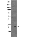 Western blot analysis of CDC42 expression in  Hela cell lysate,The lane on the left is treated with the antigen-specific peptide.