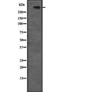 DF2310 at 1/100 staining Mouse kidney tissue by IHC-P. The sample was formaldehyde fixed and a heat mediated antigen retrieval step in citrate buffer was performed. The sample was then blocked and incubated with the antibody for 1.5 hours at 22¡ãC. An HRP conjugated goat anti-rabbit antibody was used as the secondary