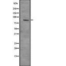 DF2311 at 1/100 staining Human gastric tissue by IHC-P. The sample was formaldehyde fixed and a heat mediated antigen retrieval step in citrate buffer was performed. The sample was then blocked and incubated with the antibody for 1.5 hours at 22¡ãC. An HRP conjugated goat anti-rabbit antibody was used as the secondary