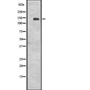 Western blot analysis of CENPJ expression in  Jurkat cell lysate,The lane on the left is treated with the antigen-specific peptide.