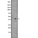 DF2313 at 1/100 staining Human lung tissue by IHC-P. The sample was formaldehyde fixed and a heat mediated antigen retrieval step in citrate buffer was performed. The sample was then blocked and incubated with the antibody for 1.5 hours at 22¡ãC. An HRP conjugated goat anti-rabbit antibody was used as the secondary