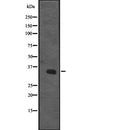 DF2316 at 1/100 staining Mouse liver tissue by IHC-P. The sample was formaldehyde fixed and a heat mediated antigen retrieval step in citrate buffer was performed. The sample was then blocked and incubated with the antibody for 1.5 hours at 22¡ãC. An HRP conjugated goat anti-rabbit antibody was used as the secondary