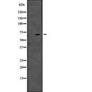 DF2319 at 1/100 staining Mouse lung tissue by IHC-P. The sample was formaldehyde fixed and a heat mediated antigen retrieval step in citrate buffer was performed. The sample was then blocked and incubated with the antibody for 1.5 hours at 22¡ãC. An HRP conjugated goat anti-rabbit antibody was used as the secondary