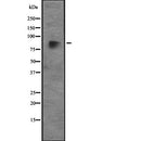 Western blot analysis of CUL4A expression in  Hela cell lysate,The lane on the left is treated with the antigen-specific peptide.