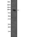 Western blot analysis of CUL4B expression in Transfected 293T cell lysate,The lane on the left is treated with the antigen-specific peptide.