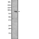 Western blot analysis of CUL5 expression in  Hela cell lysate,The lane on the left is treated with the antigen-specific peptide.