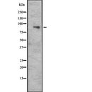 Western blot analysis of CUL5 expression in  Hela cell lysate,The lane on the left is treated with the antigen-specific peptide.
