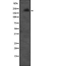 Western blot analysis of CUL7 expression in  Molt-4 cell lysate ;,The lane on the left is treated with the antigen-specific peptide.